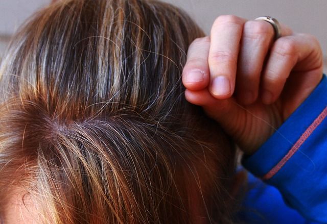 बालों को कम उम्र में सफ़ेद होने से रोकने के लिए घरेलू नुस्खे – Home remedies to prevent hair turning gray at a young age