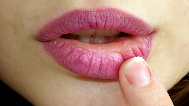 घरेलु नुश्खे से होंठ की परेशानी से छुटकारा – Get rid of lip discomfort with home remedies